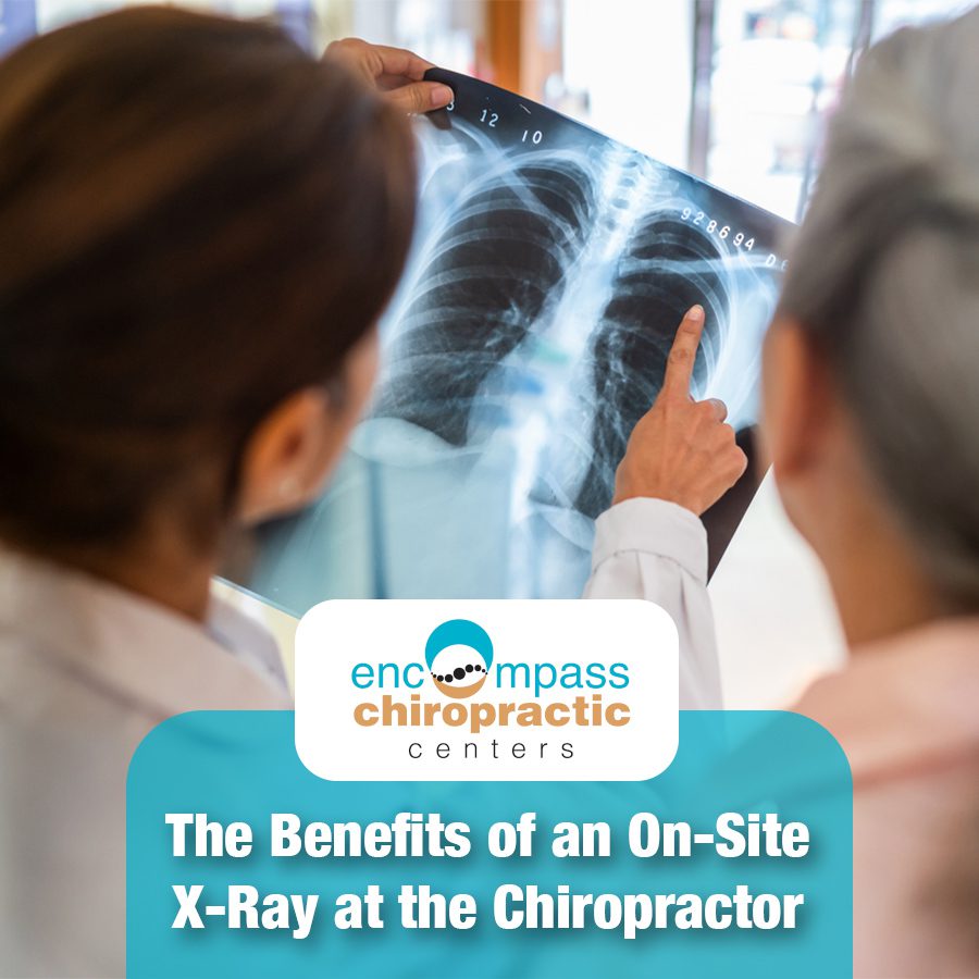 The Benefits of an On-Site X-Ray at the Chiropractor