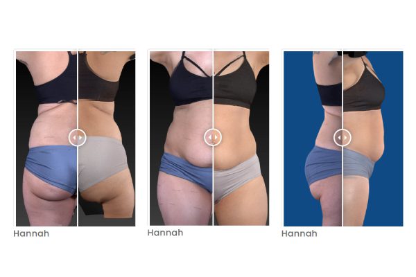 Encompass Body Image