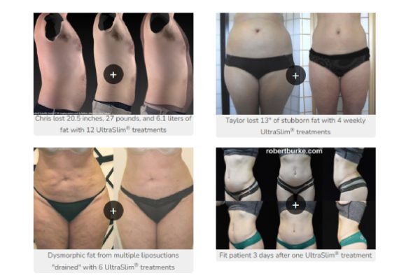 Encompass Body Image